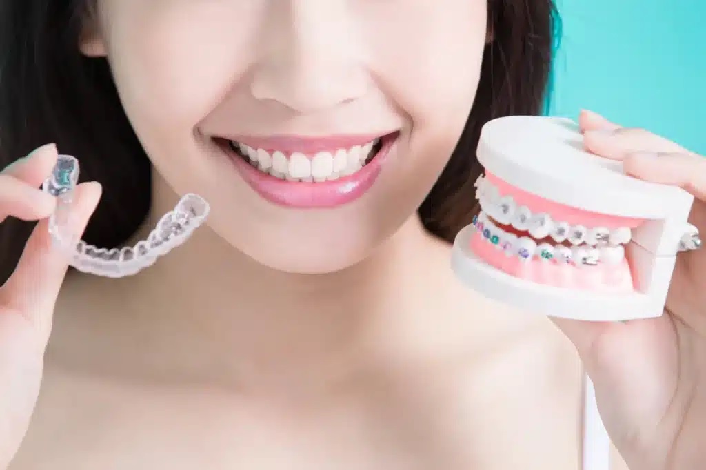 Invisalign Braces